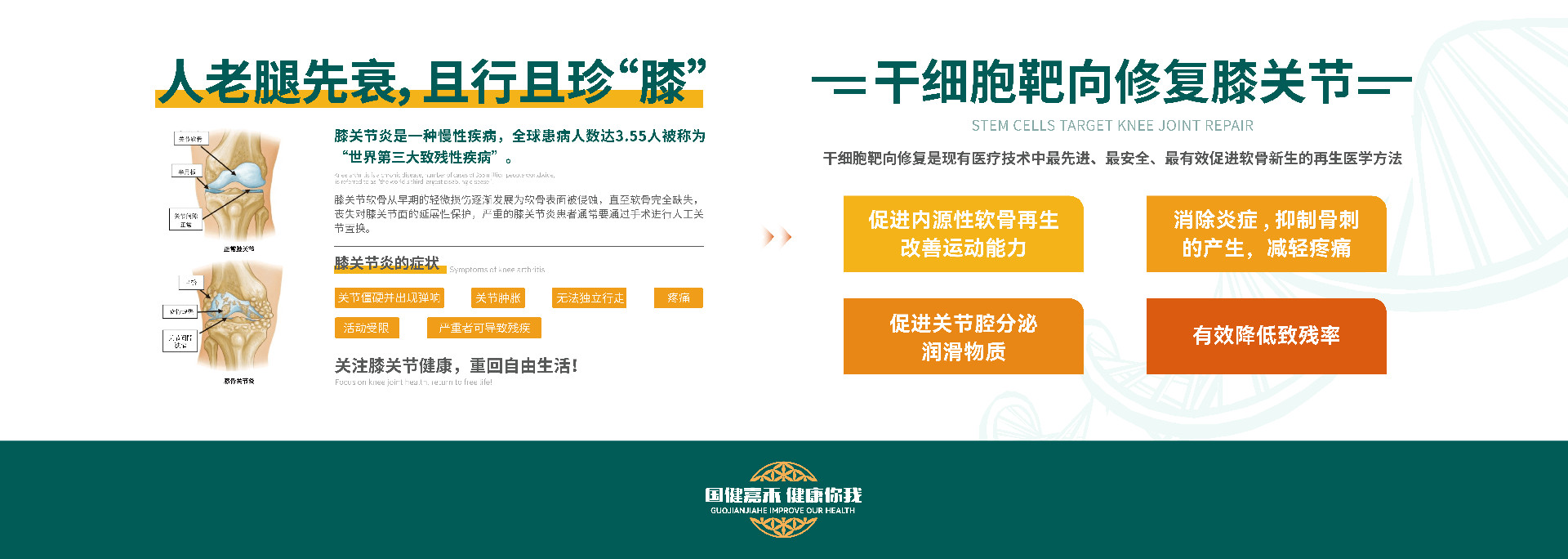 干细胞靶向修复膝关节